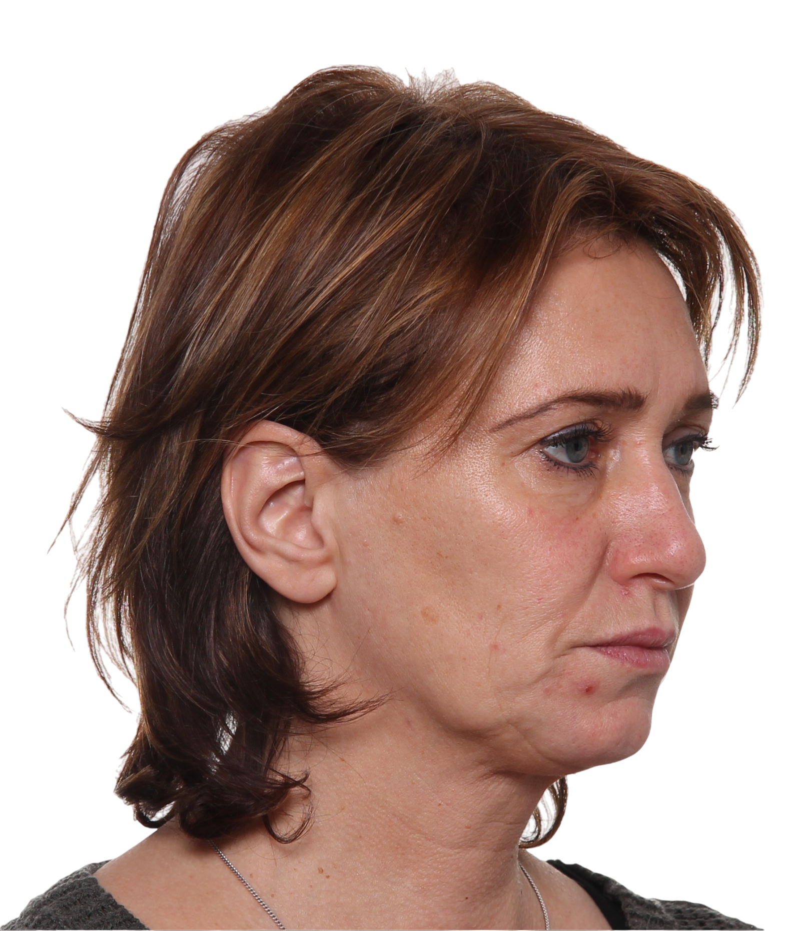 Resultaat 2: voor de behandeling